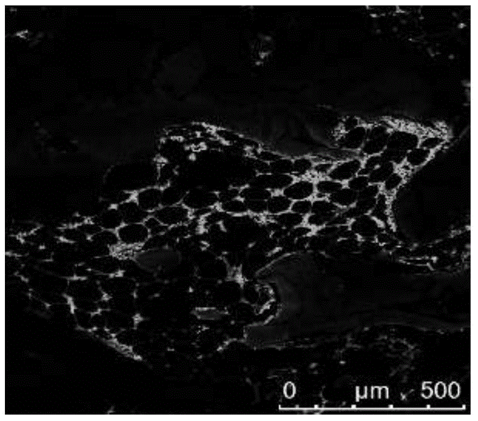 Construction and application for tissue-engineered bone with BMSCs transfected with genes in combining manner