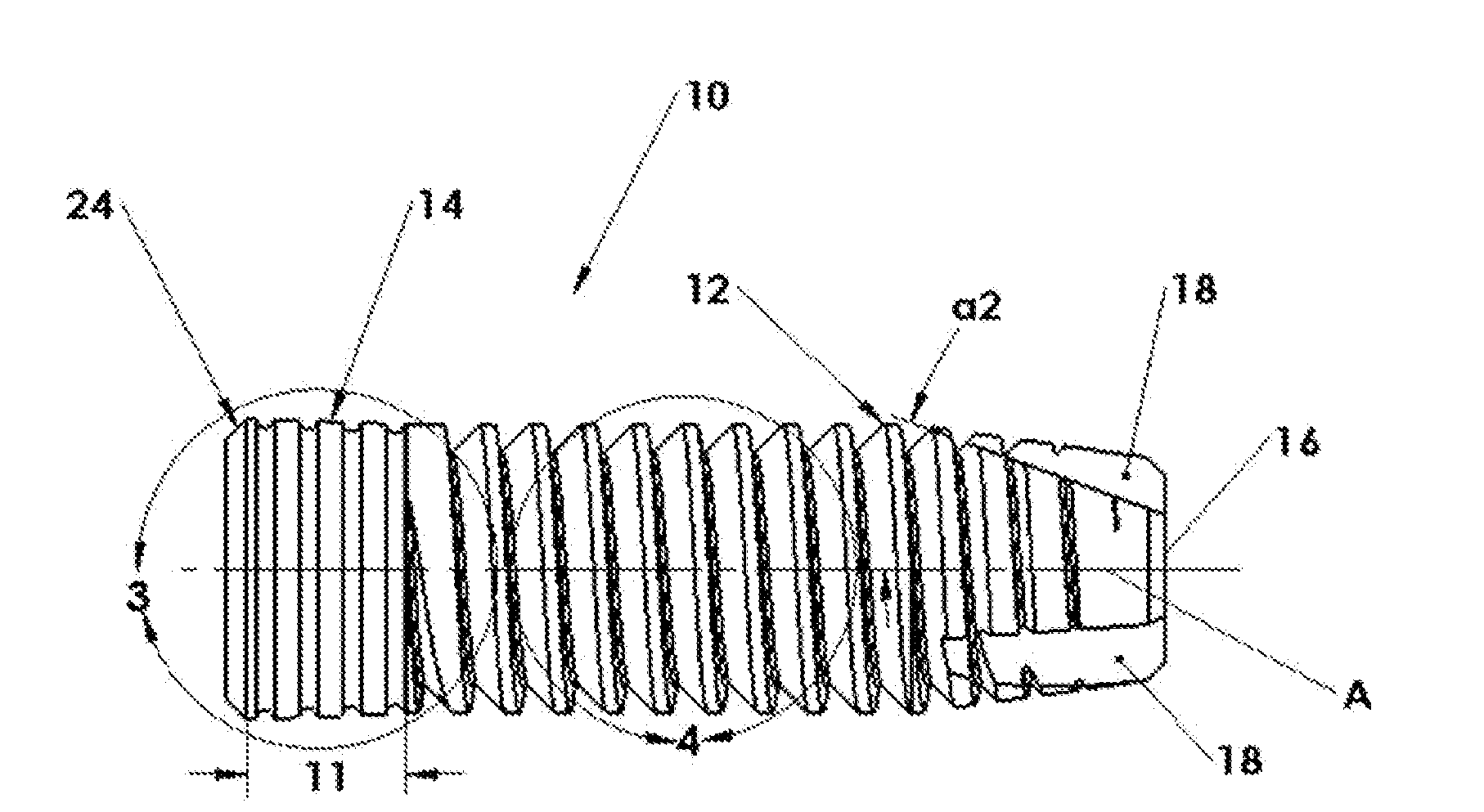 Dental Implant