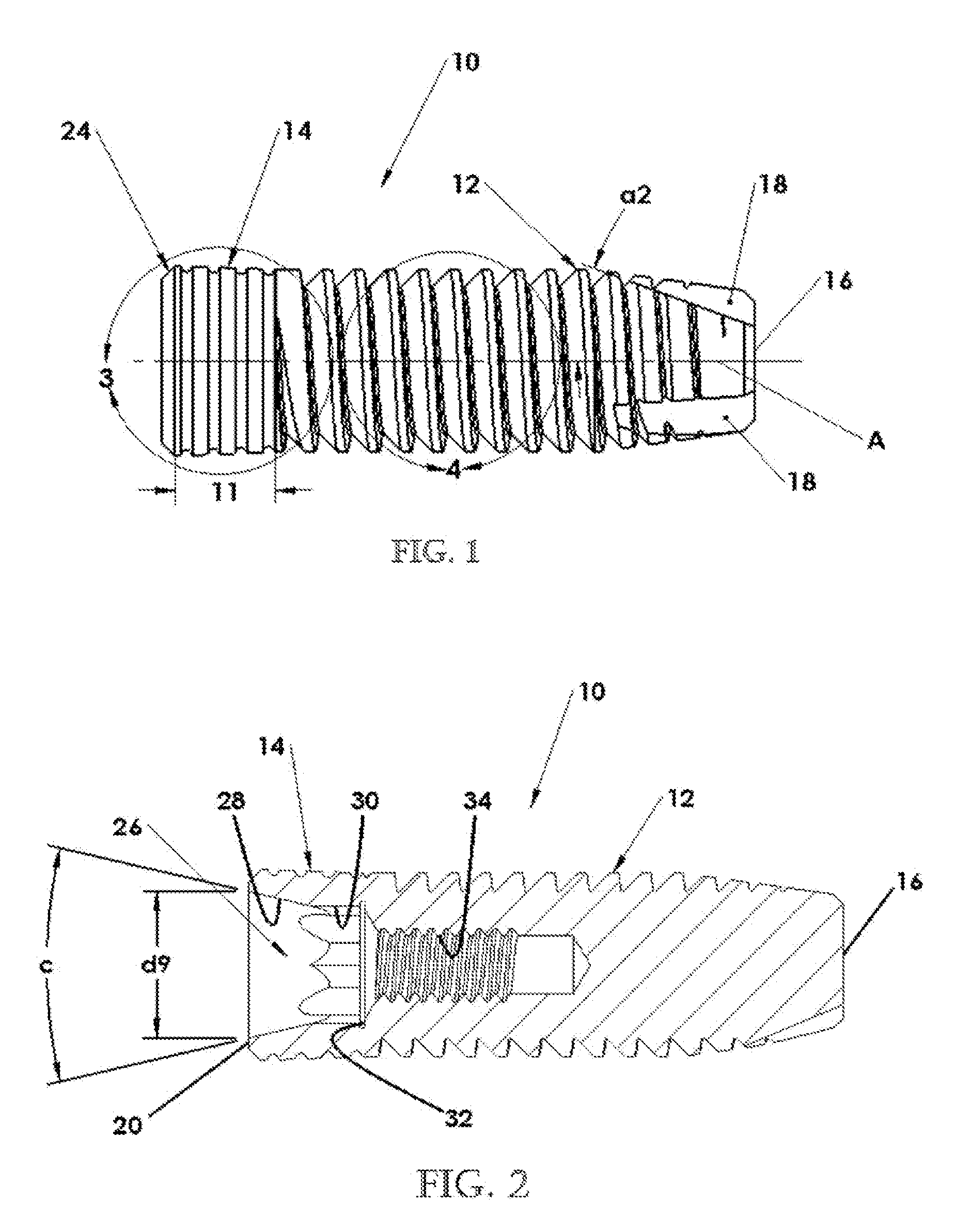 Dental Implant