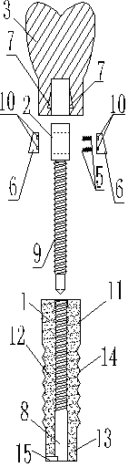 Dental implant