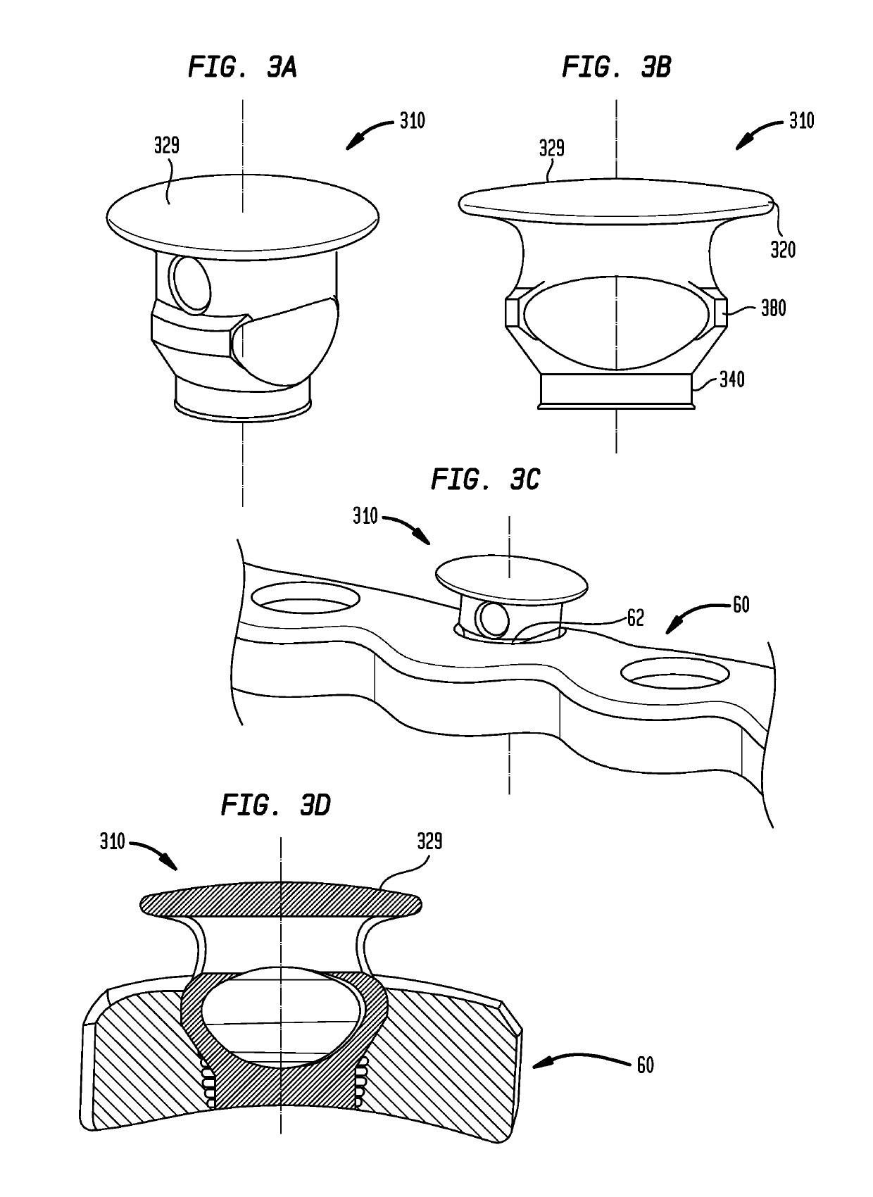 Cable plugs for bone plates