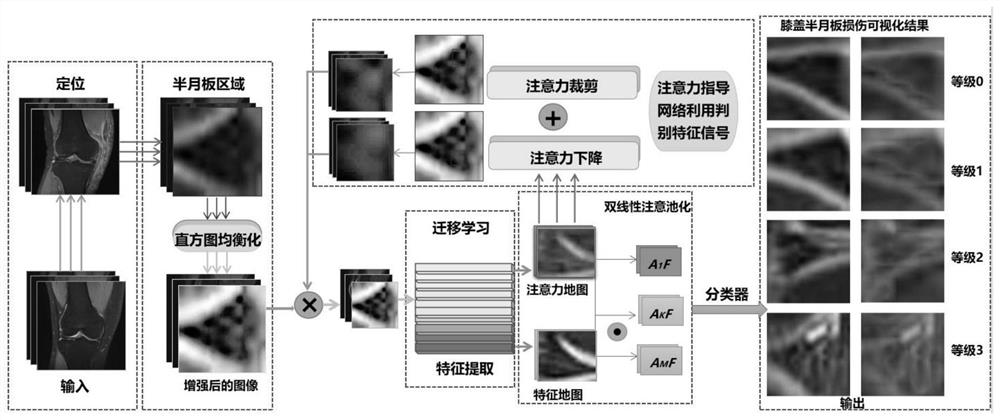 Meniscus injury grading method based on mixed attention weakness supervised transfer learning