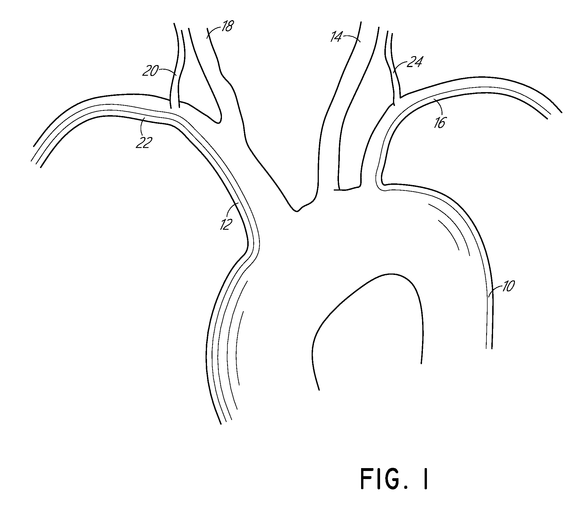 Vascular filters, deflectors, and methods