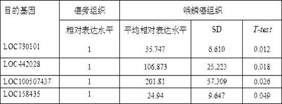 Molecular marker related to incidence and development of laryngeal carcinoma