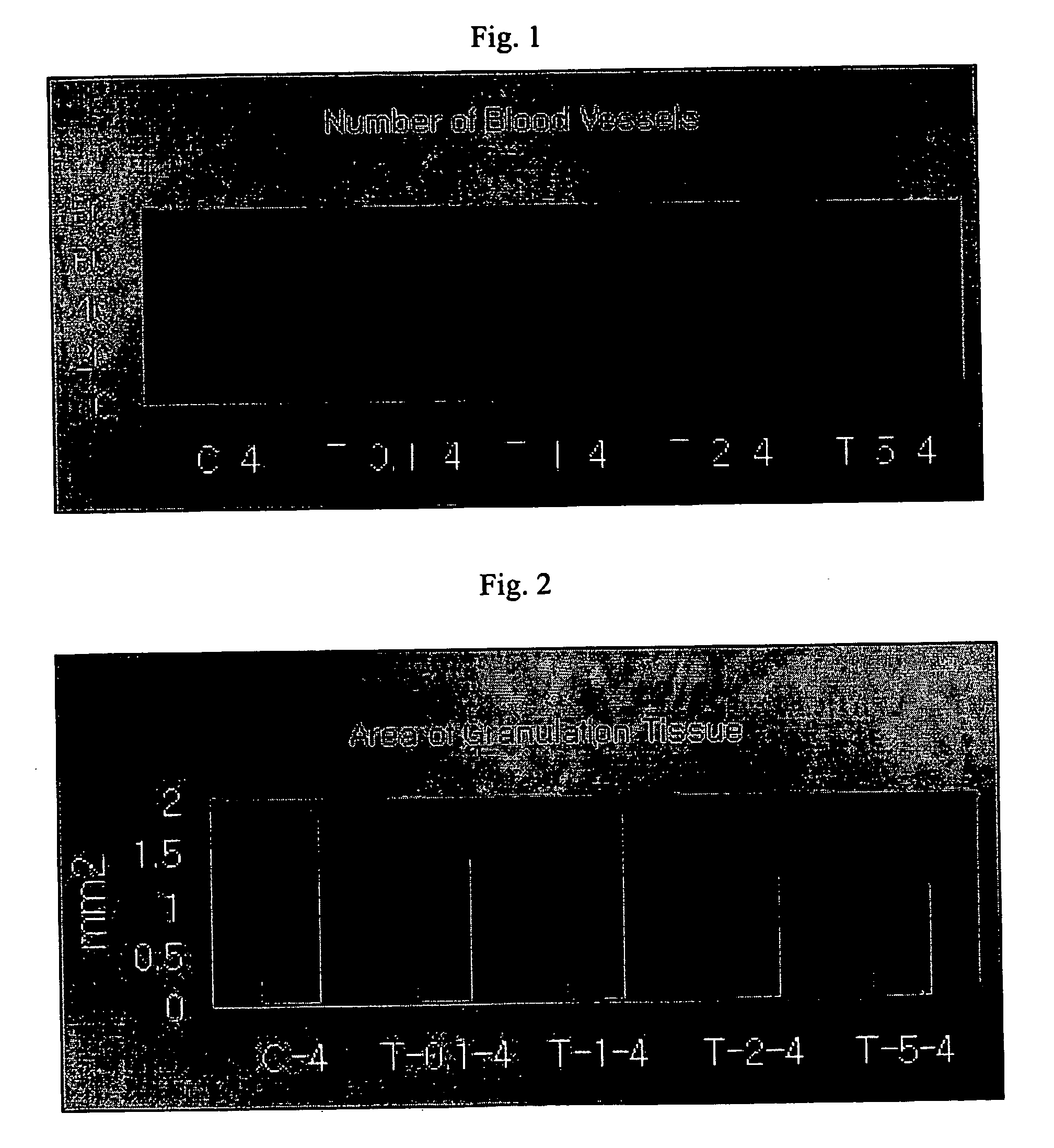 Inhibitor of angiogenesis and kit for treating cancer comprising the inhibitor