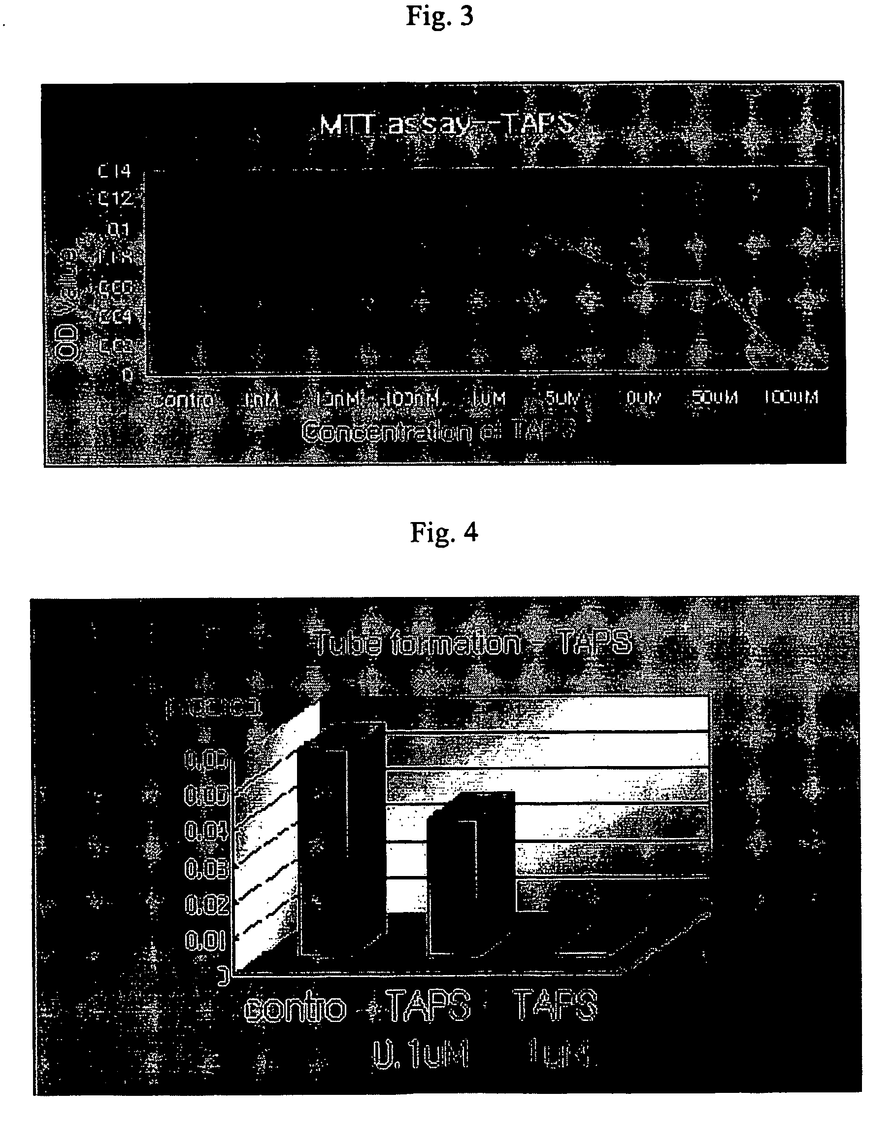 Inhibitor of angiogenesis and kit for treating cancer comprising the inhibitor