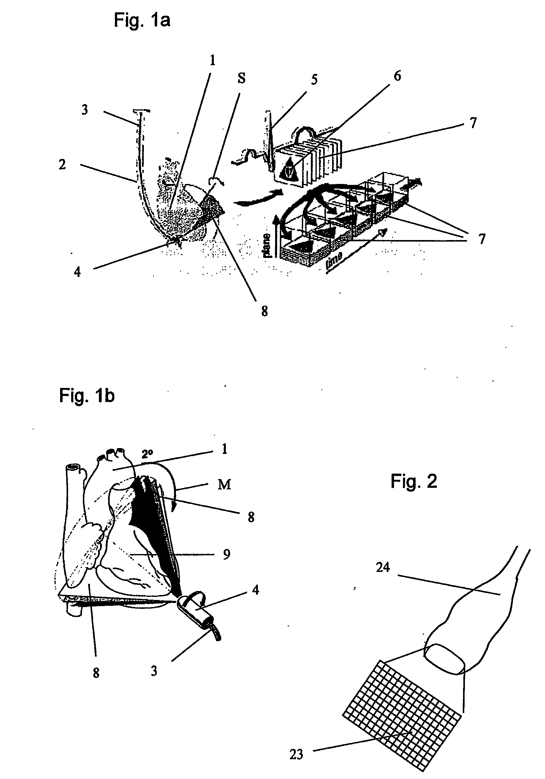 Method And Apparatus For Detecting Movements OF Objects