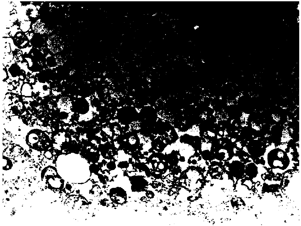 B cell vaccine based on Hepal-6 hepatoma cell autophagosome-DRibbles and preparation method of B cell vaccine