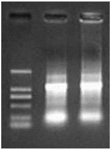 Gene expression profile detection kit for predicting breast cancer reoccurrence of Chinese population