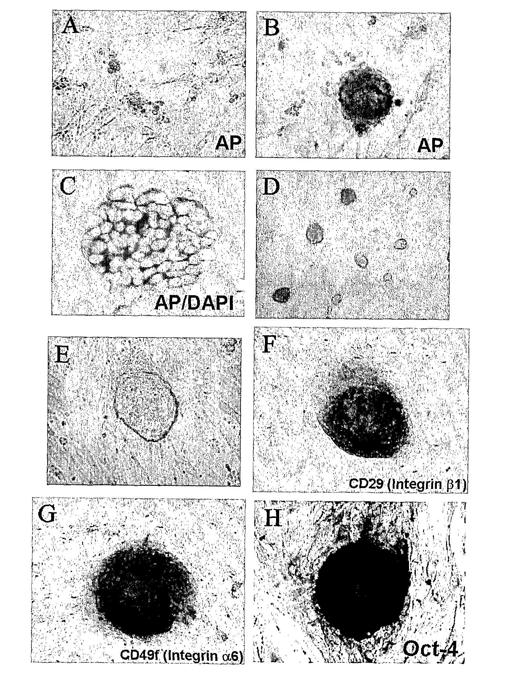 In Vitro Method for Isolating, Proliferating and Differentiating Germ-Line Stem Cells