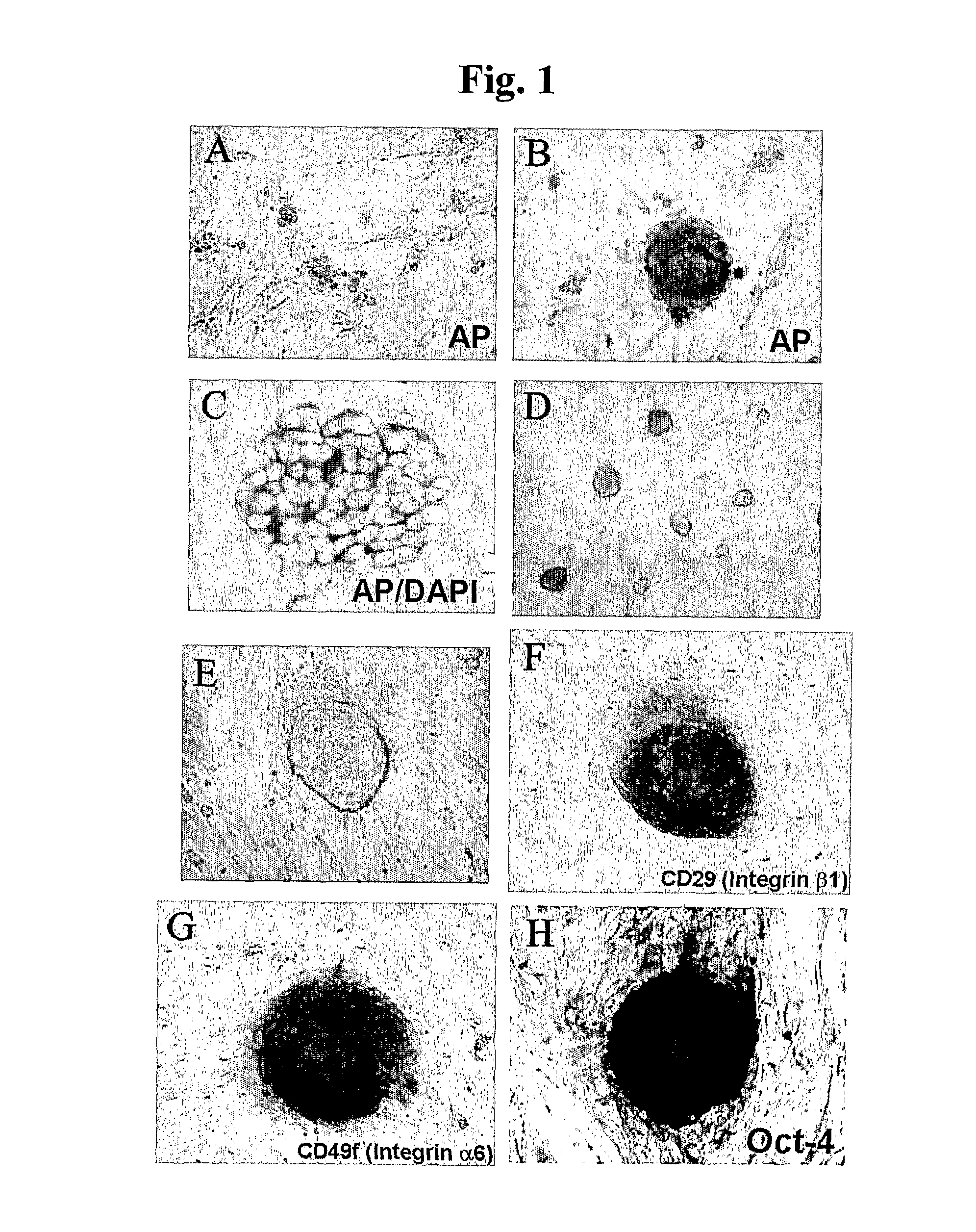 In Vitro Method for Isolating, Proliferating and Differentiating Germ-Line Stem Cells