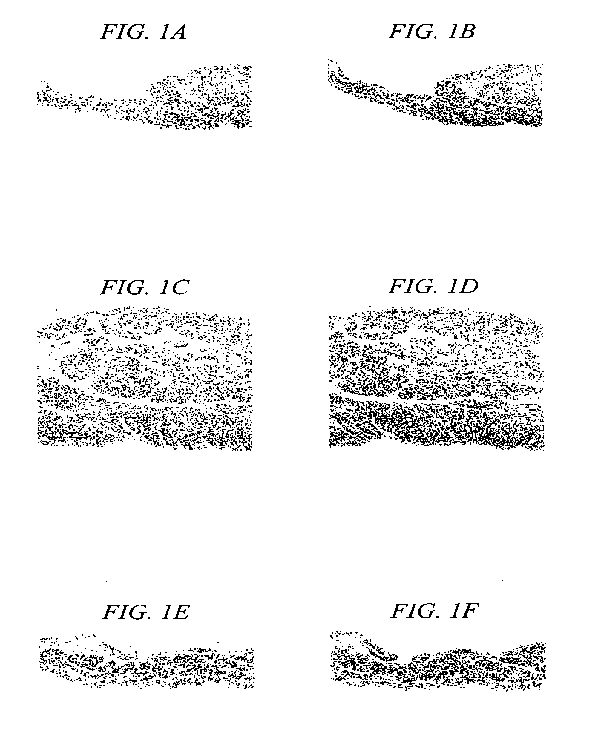 Methods and Apparatus for Locating the Fossa Ovalis and Performing Transseptal Puncture