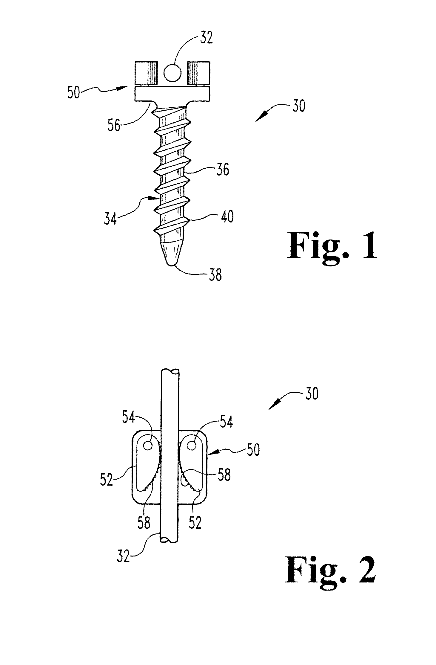 System and method for correcting spinal deformity