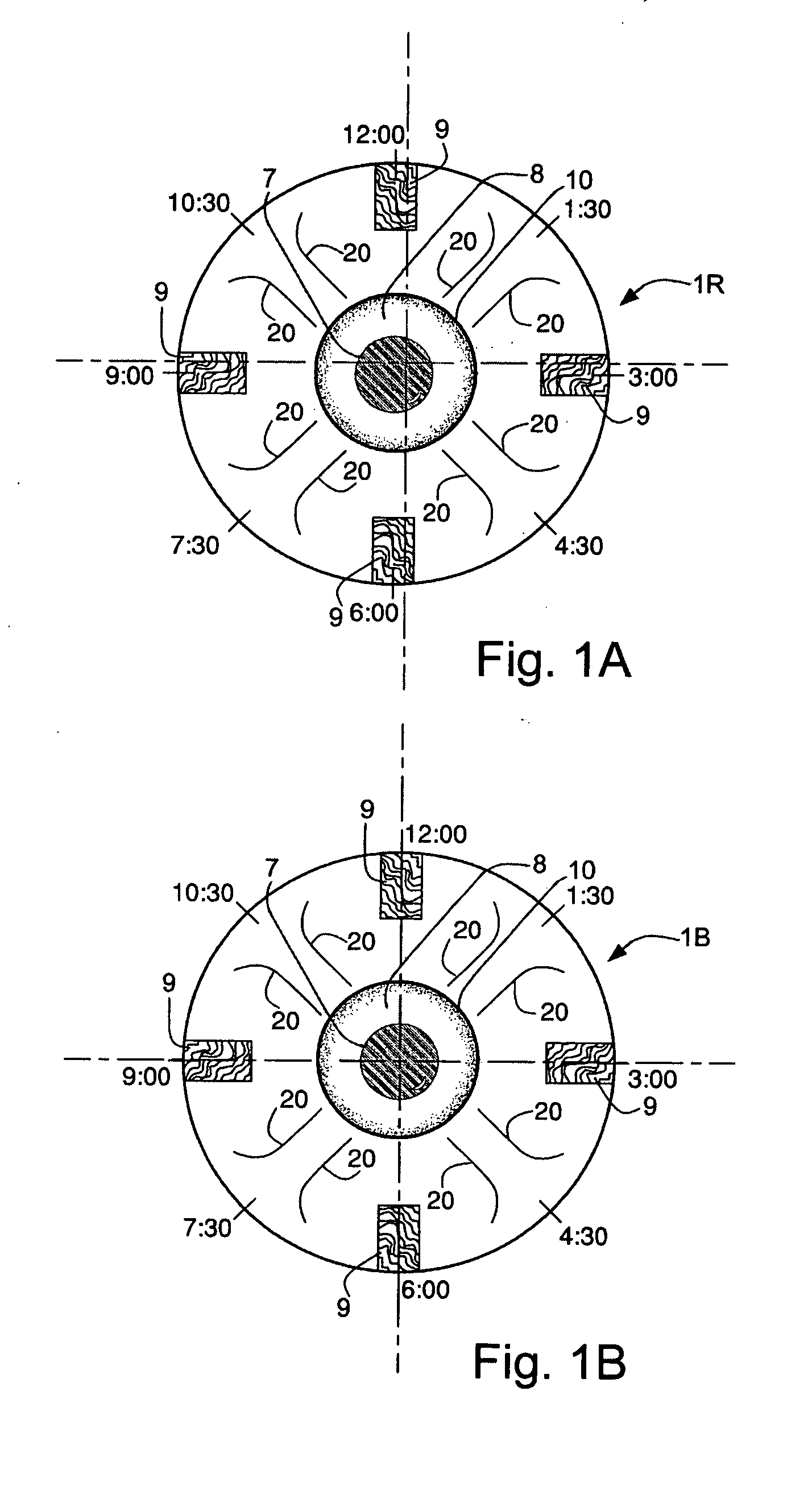 Method and system for radio frequency ophthalmological presbyopia surgery