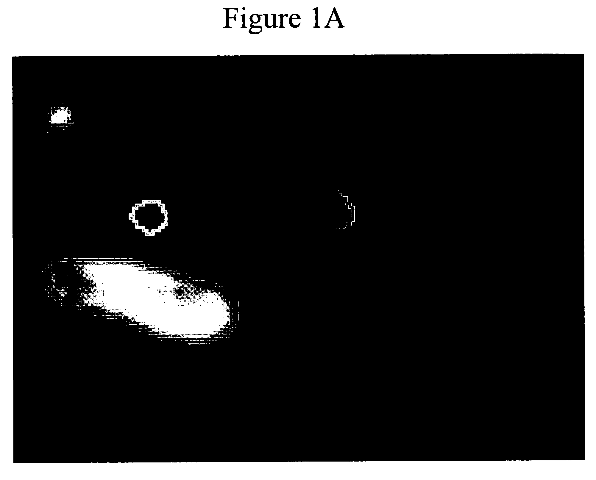 System and method for identifying optimized blood signal in medical images to eliminate flow artifacts