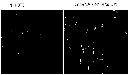 Preparation and application of a long-chain non-coding RNA nanosphere