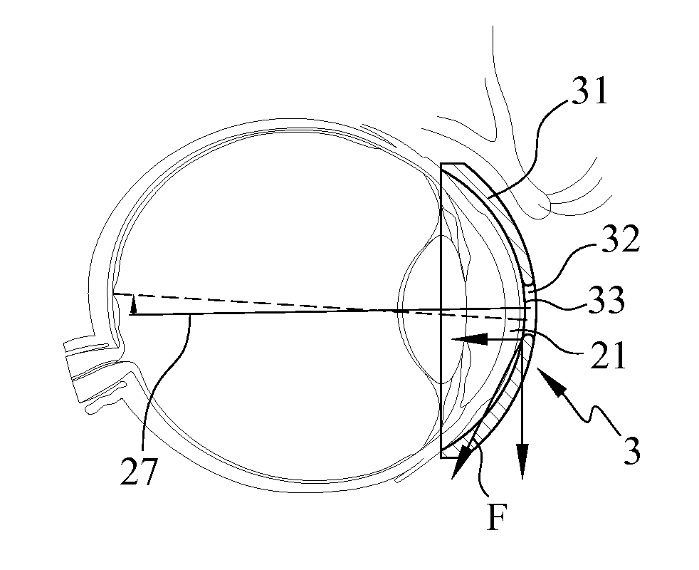 Assistive device for aiding vision correction and rehabilitation