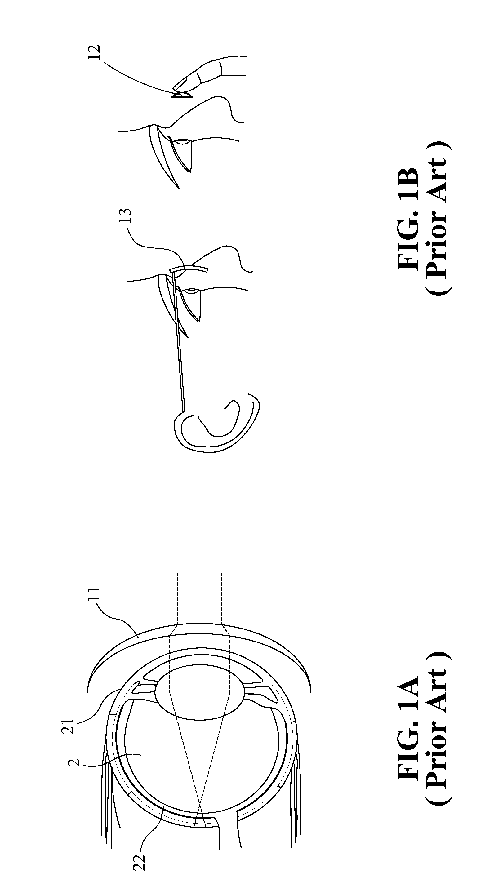 Assistive device for aiding vision correction and rehabilitation