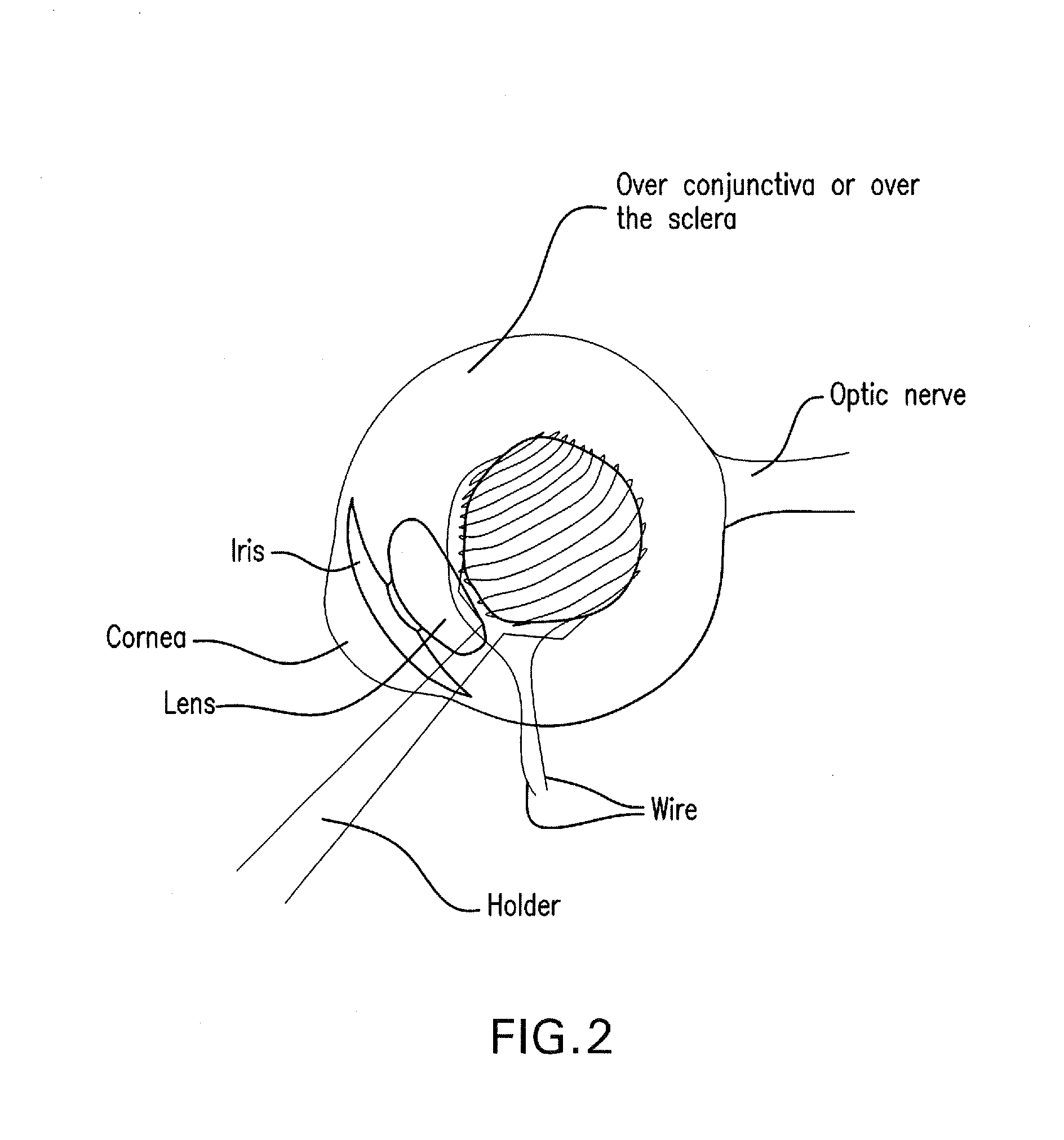 Method and composition for hyperthermally treating cells