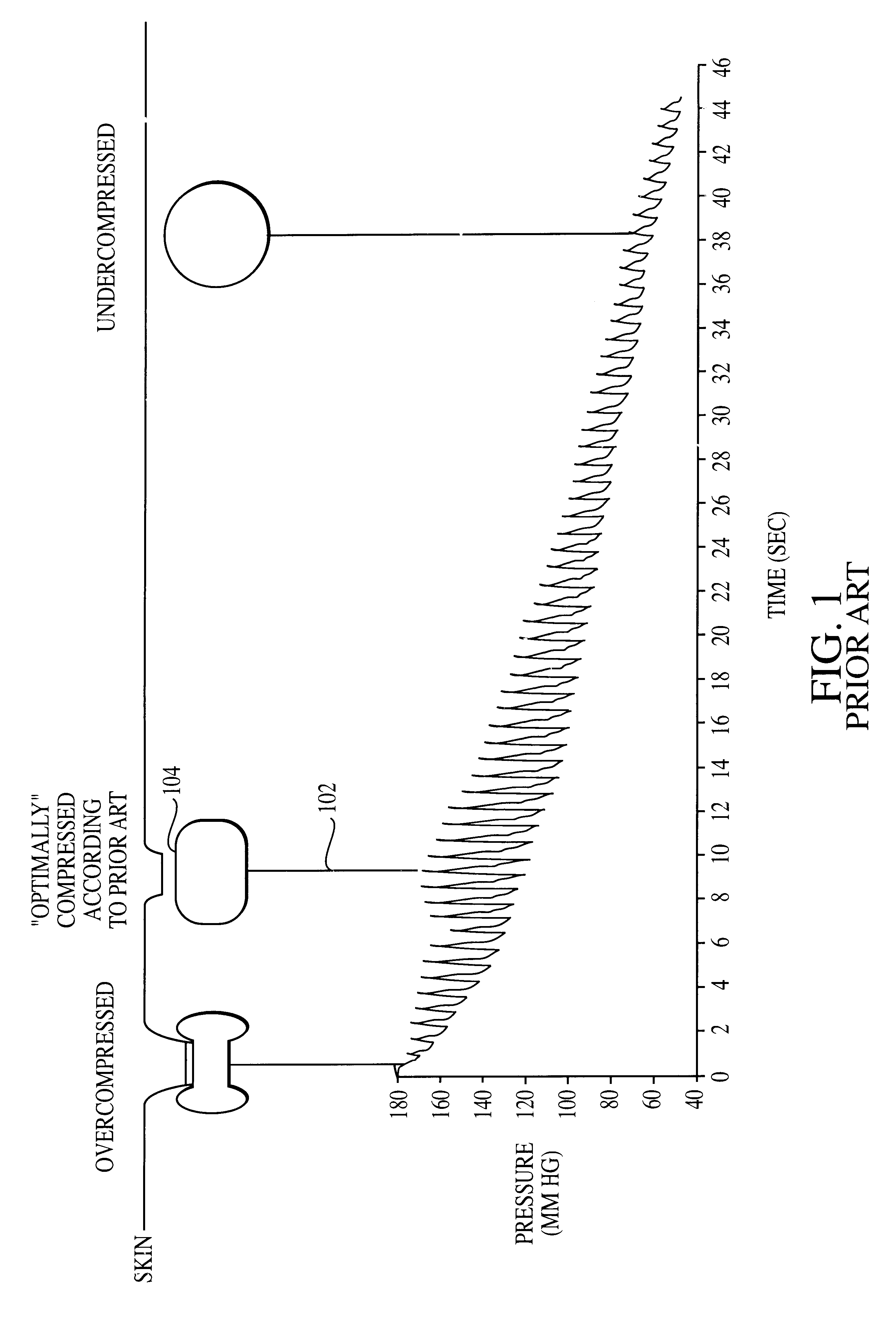 Method and apparatus for the noninvasive determination of arterial blood pressure