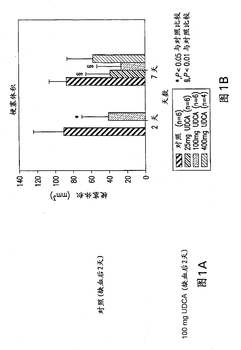 Neuroprotective effect of solubilized UDCA in focal ischemic model