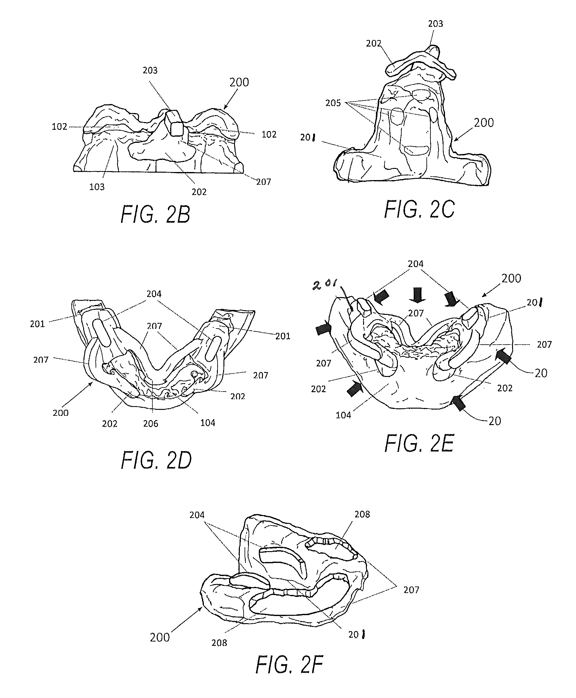 Edentulous surgical guide