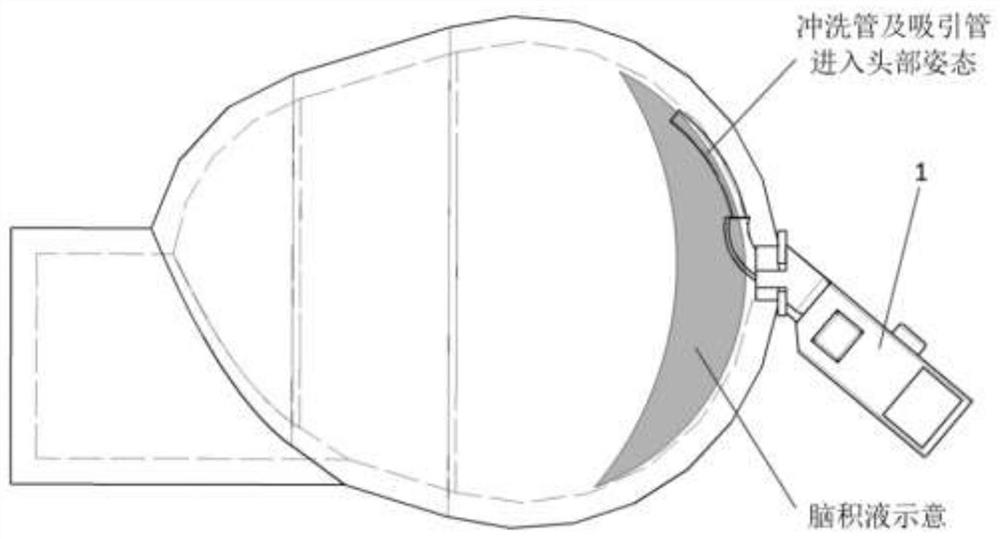 Visual hematocele cleaning device