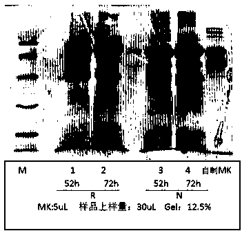 Preparation and purification method of recombinant proserum/growth hormone fusion protein for treating children dwarfism