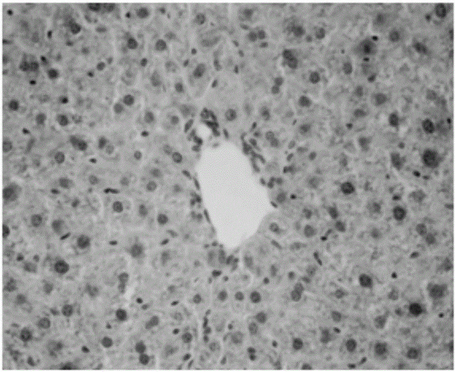 Method for establishment of non-alcoholic fatty liver disease model by utilizing ApoE-/-mice