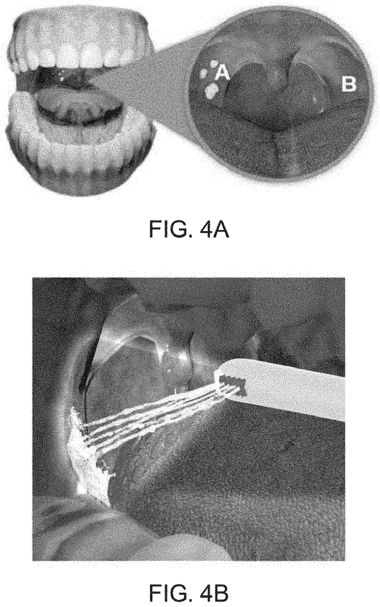 System for irrigating the upper aerodigestive tract and neighboring areas