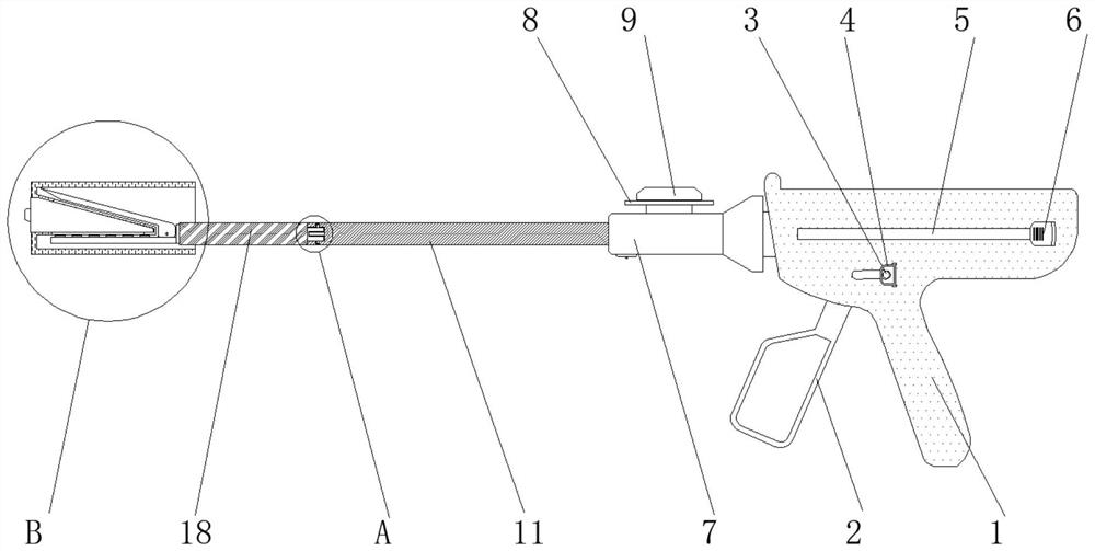 Detachable endoscope anastomat