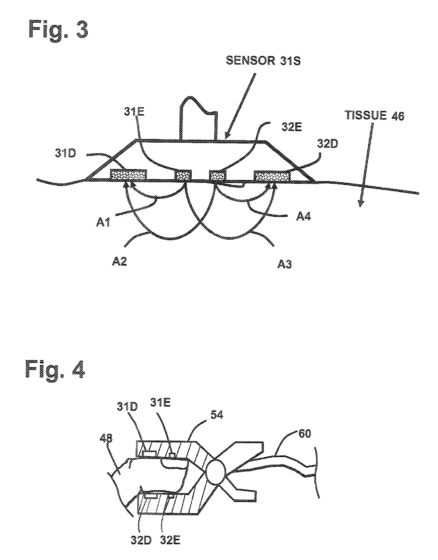 Tissue Oximetry Apparatus and Method