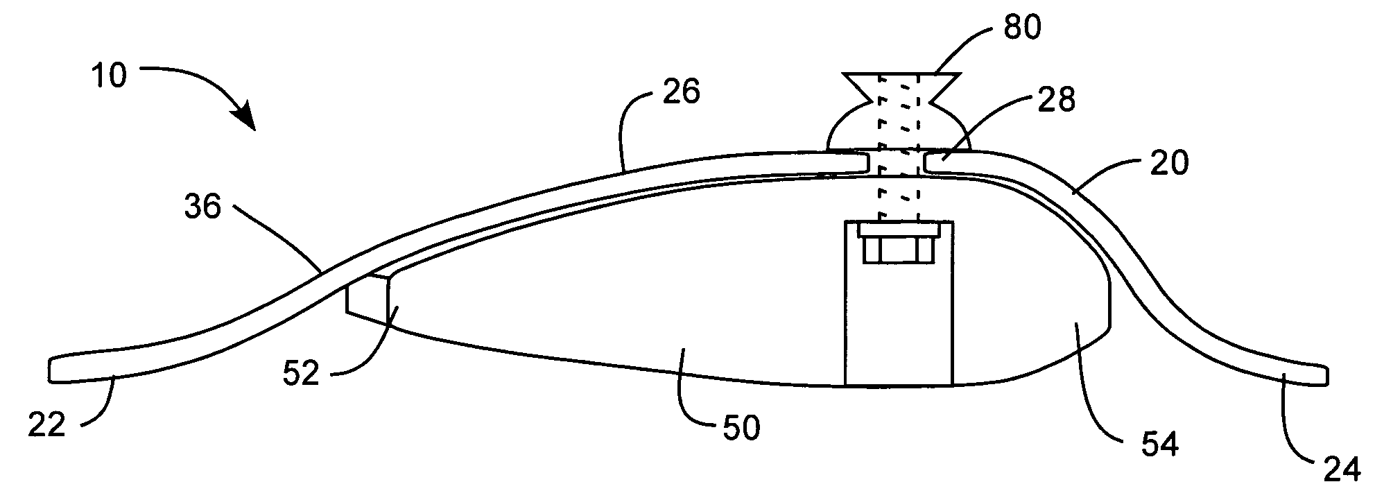 Prosthetic foot with variable medial/lateral stiffness