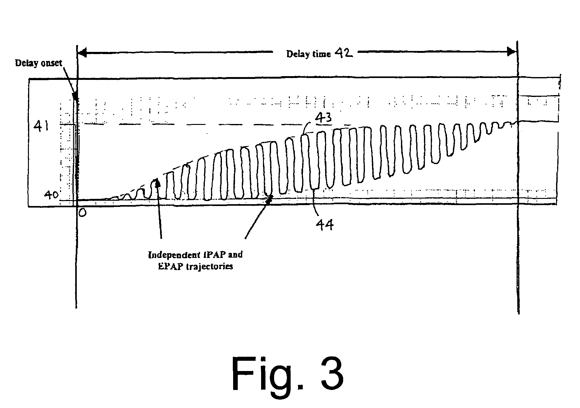 Method for acclimating a CPAP therapy patient to prescribed pressure