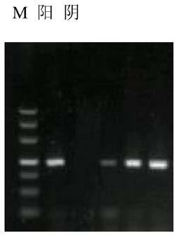 Fluid culture medium and method for isolated-culturing mycoplasma gallisepticum using same