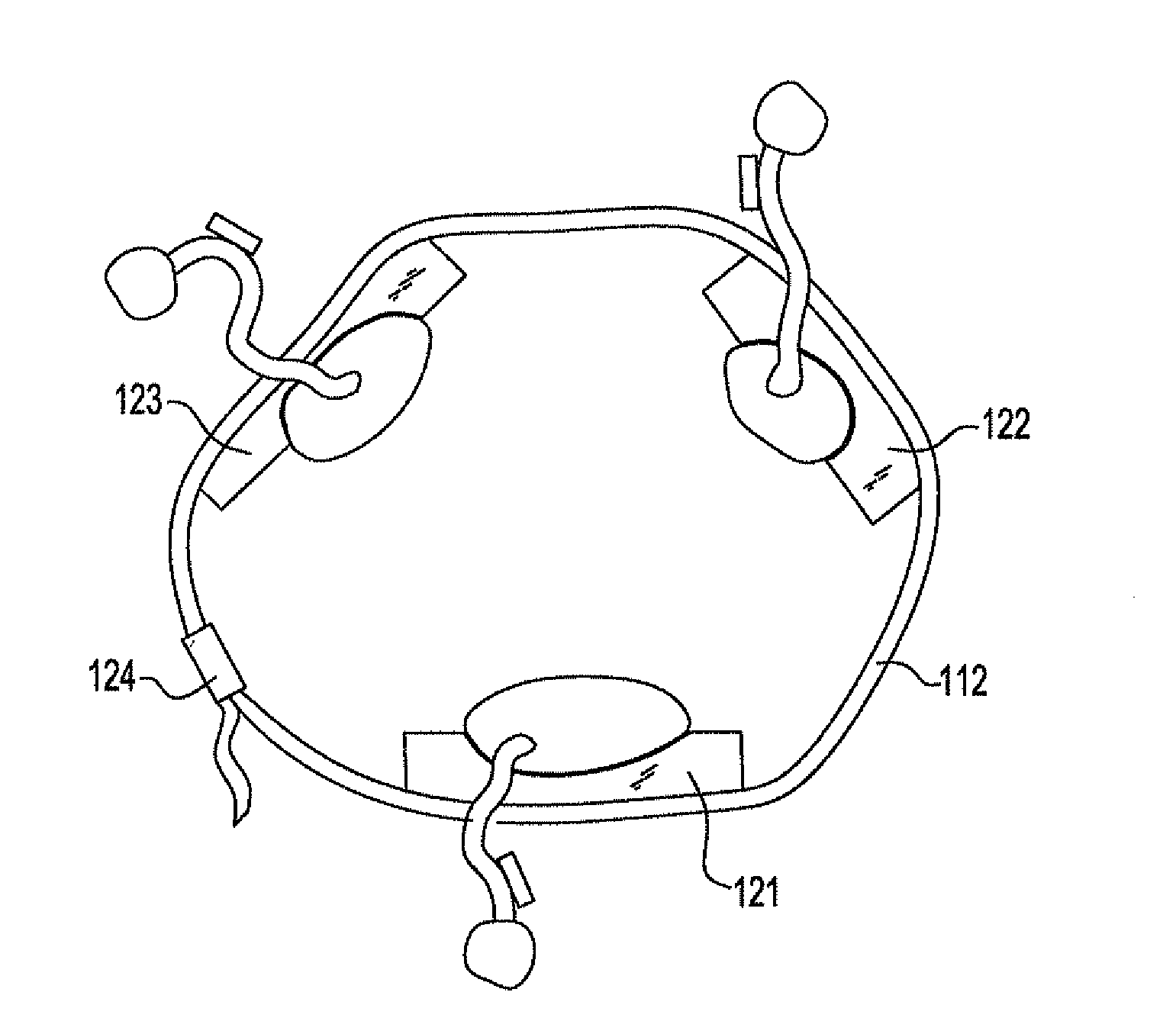 Semi-rigid compression splint for application of three-dimensional force