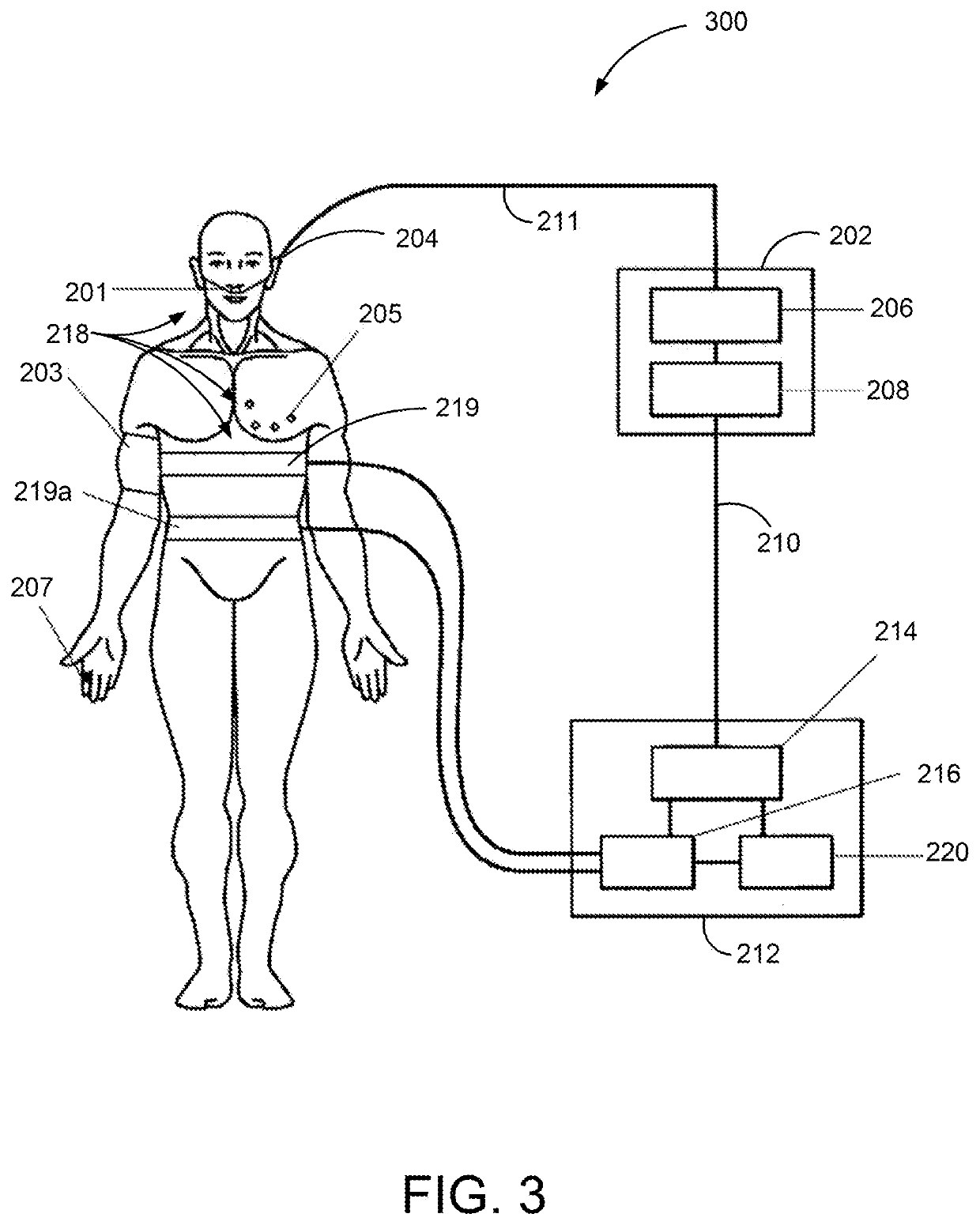 Systems and methods for respiratory-gated nerve stimulation