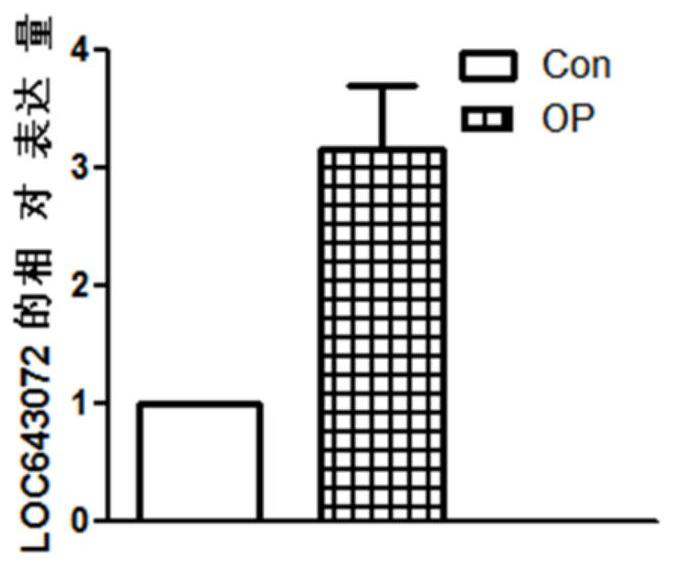 Detection of lncRNA and its application in diagnosis and treatment of osteoporosis