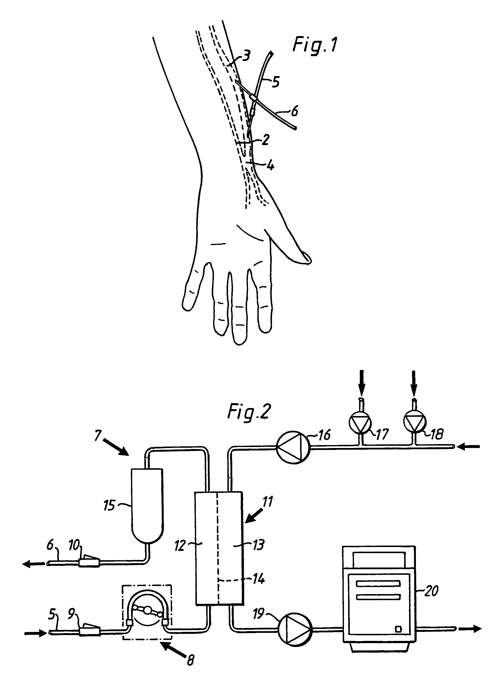 Switch valve for an extracorporeal blood circuit and circuit including such a switch valve