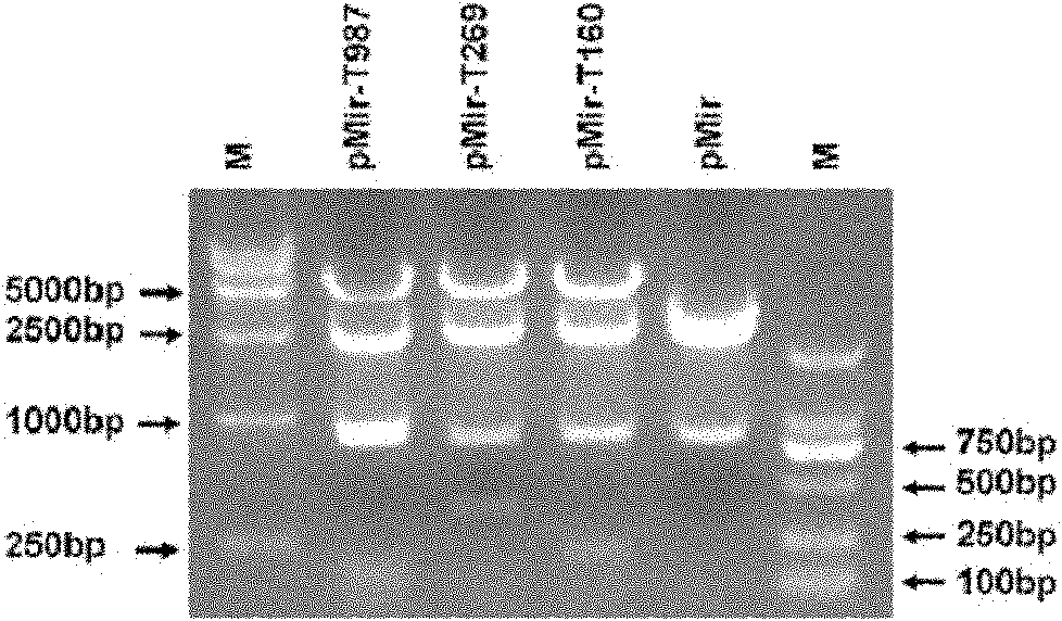 Recombinant slow virus vector, recombinant slow virus and stem cell containing recombinant slow virus