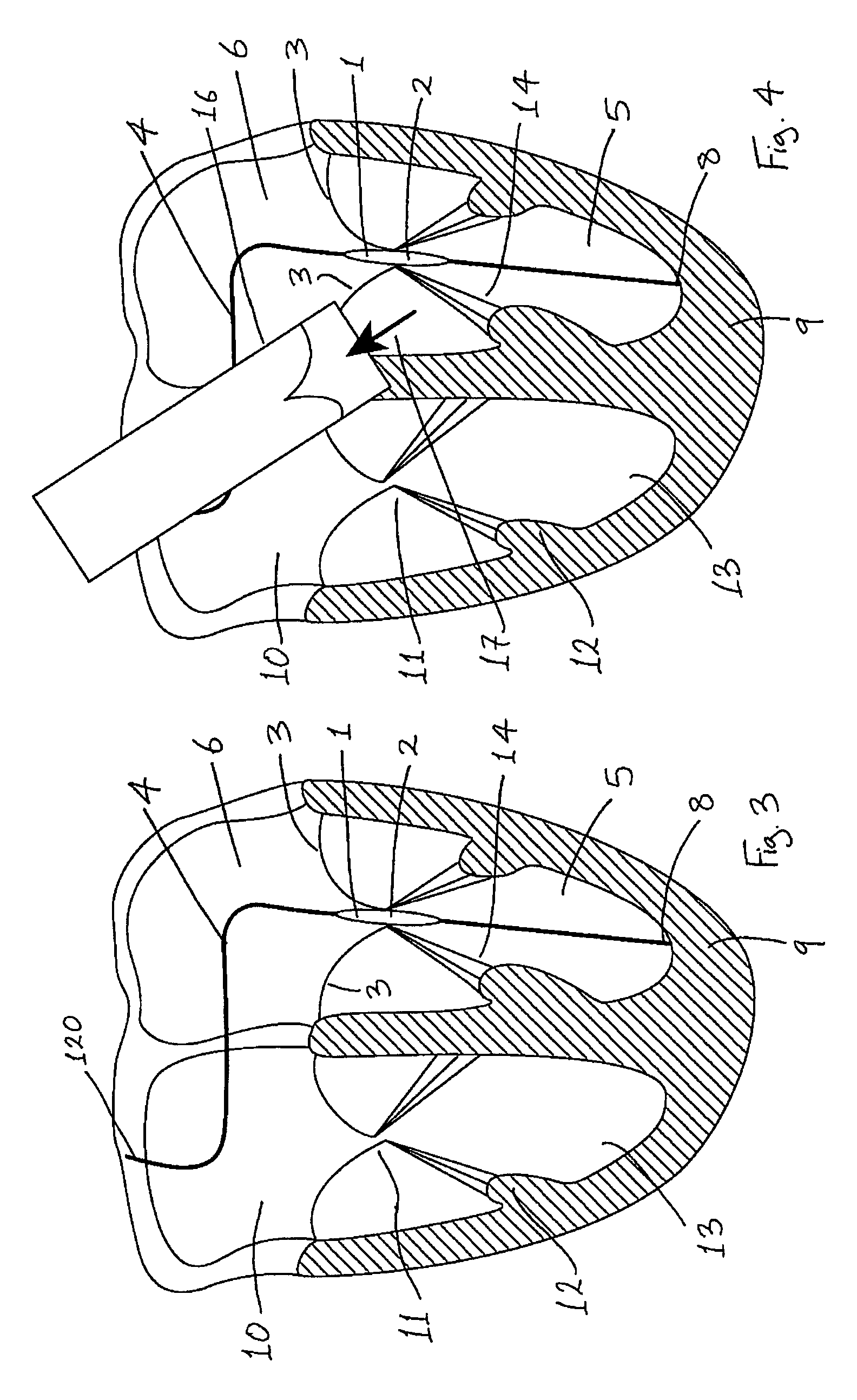 Medical device suitable for use in treatment of a valve