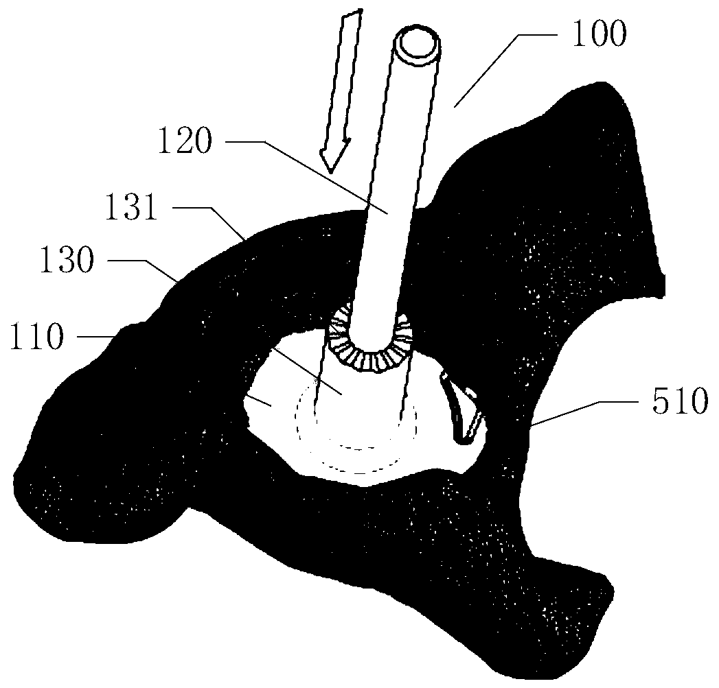 Positioning and navigation system and prosthesis implantation method