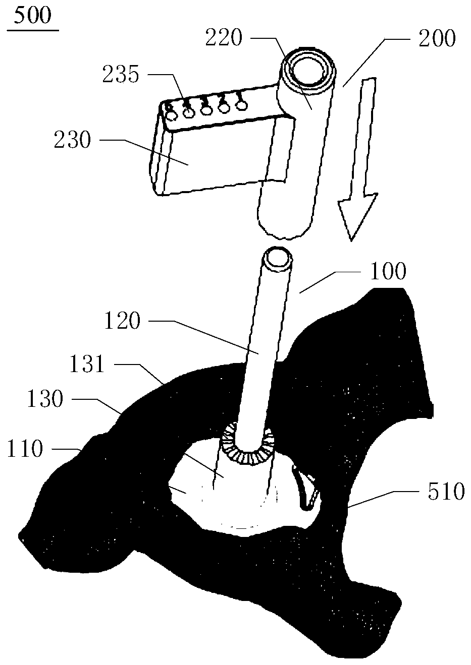 Positioning and navigation system and prosthesis implantation method