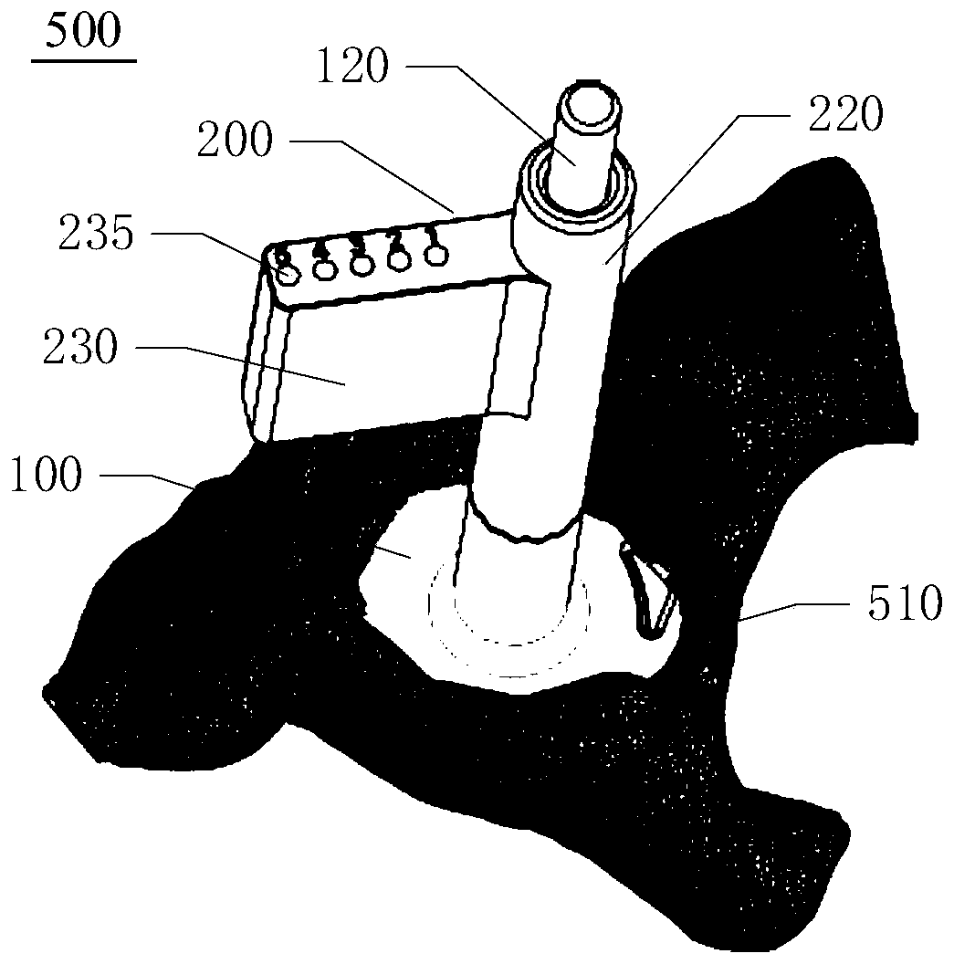 Positioning and navigation system and prosthesis implantation method