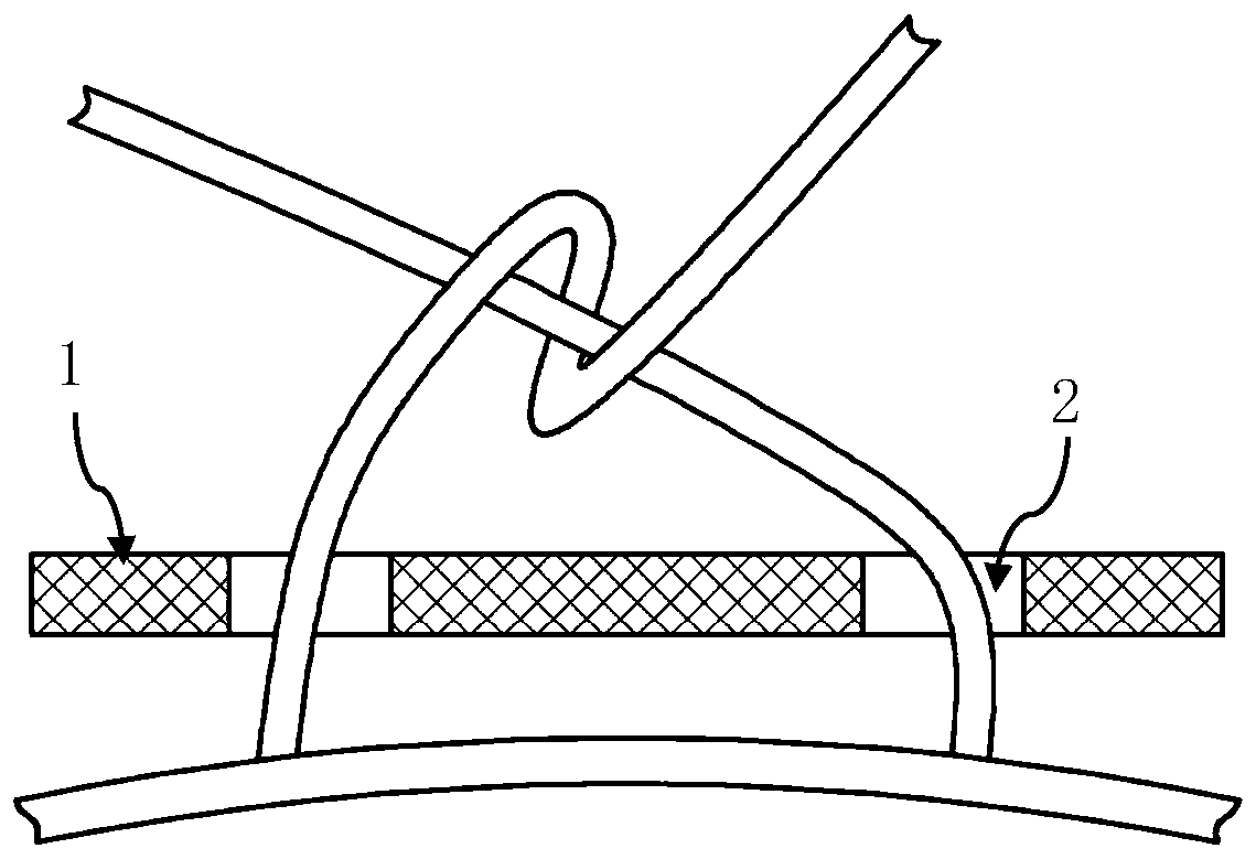 Decorative structure for trousers with drawstrings