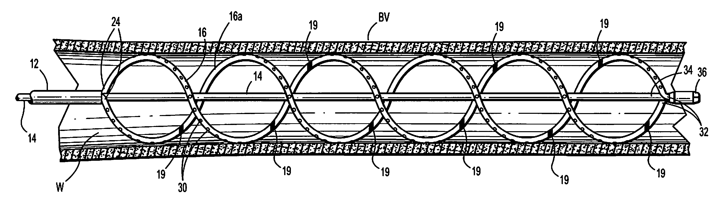 Spirally conformable infusion catheter