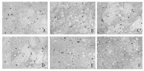 Traditional Chinese medicine composition for relieving parkinsonism motion complications