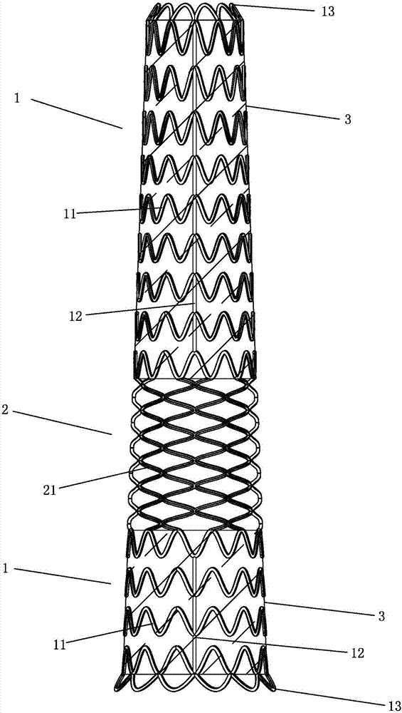 Aortic intravascular stent