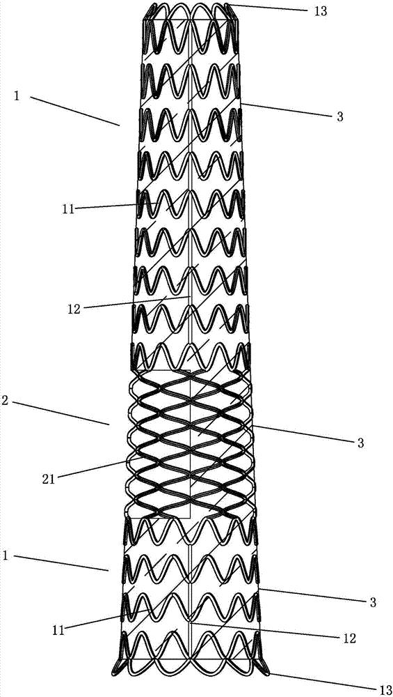 Aortic intravascular stent