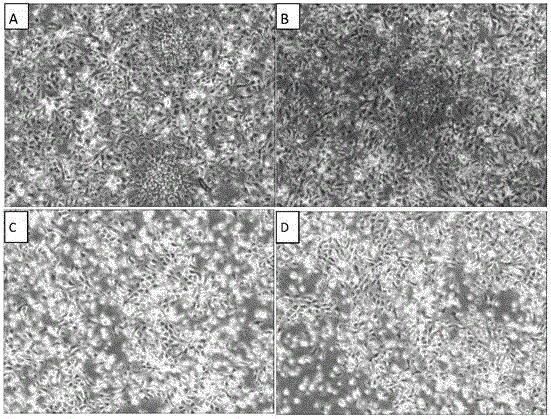 Multifunctional serum-free cell culture medium and application thereof